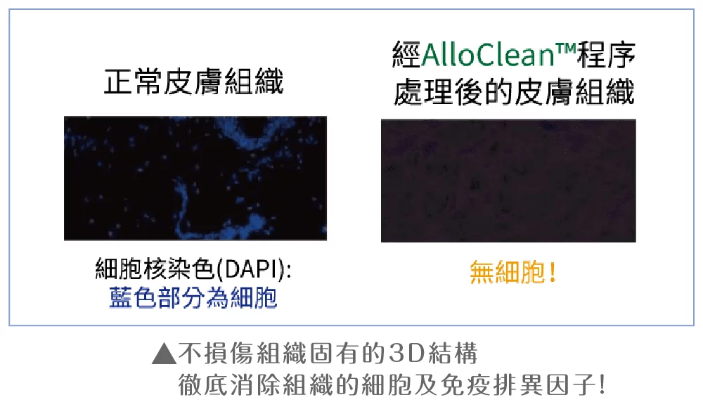 異體真皮粉 安全 01