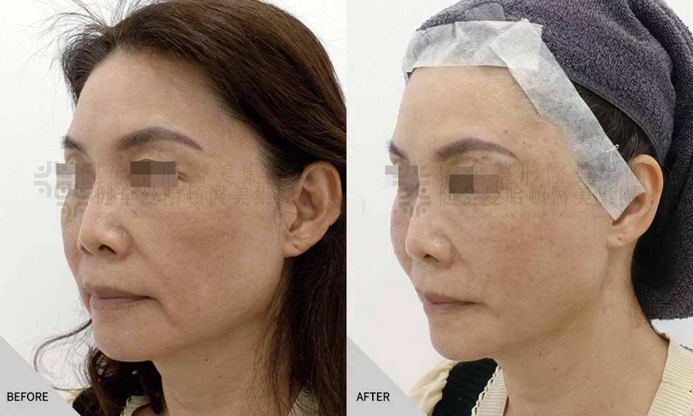 真童妍拉提術 01