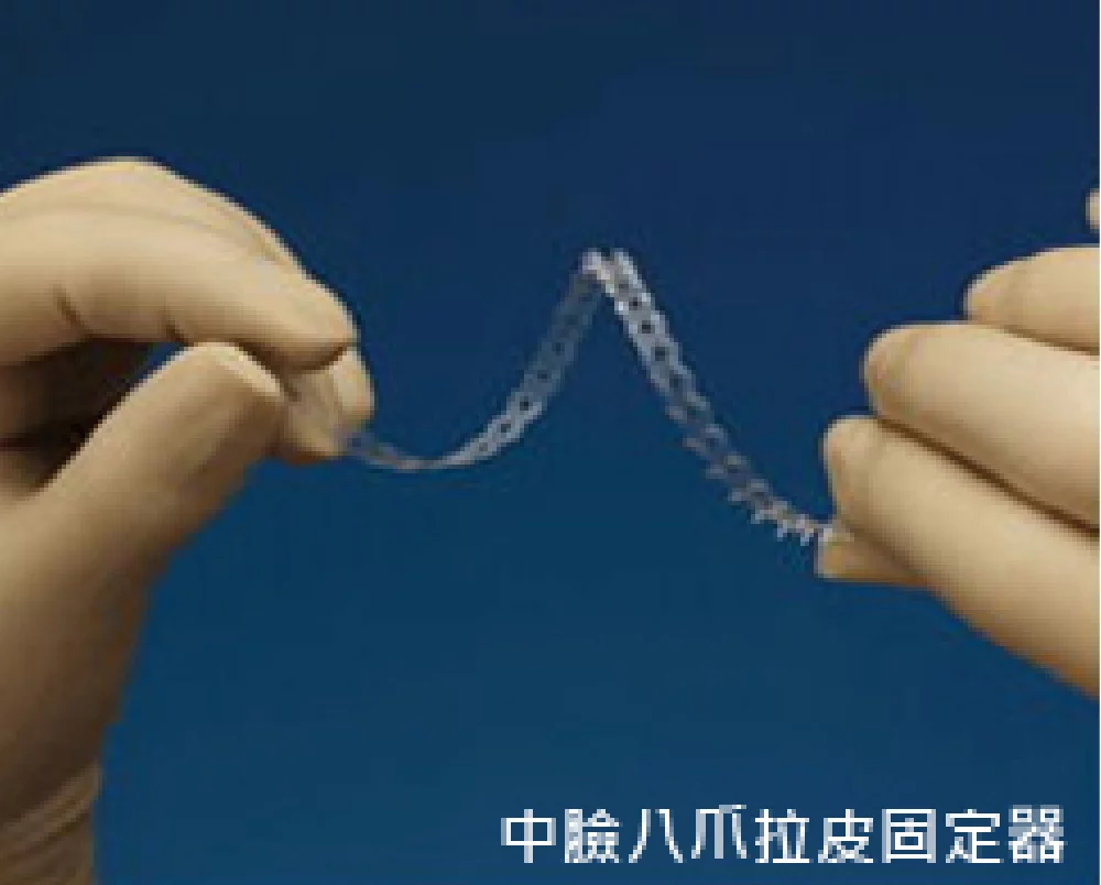 臉部拉皮手術 八爪 中額