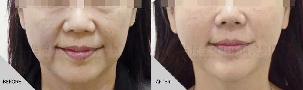 舒顏萃案例 01