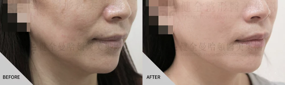 舒顏萃案例 04
