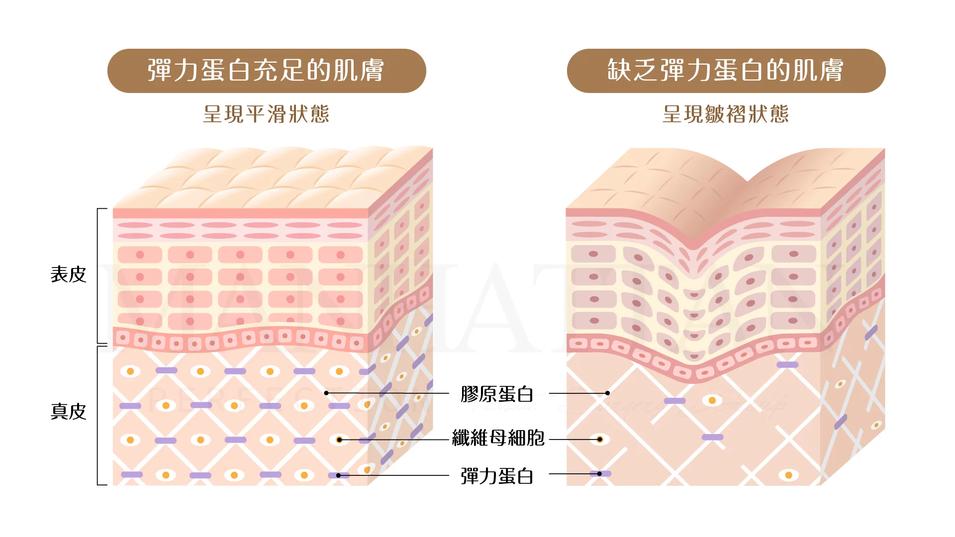 逆時針 彈力蛋白