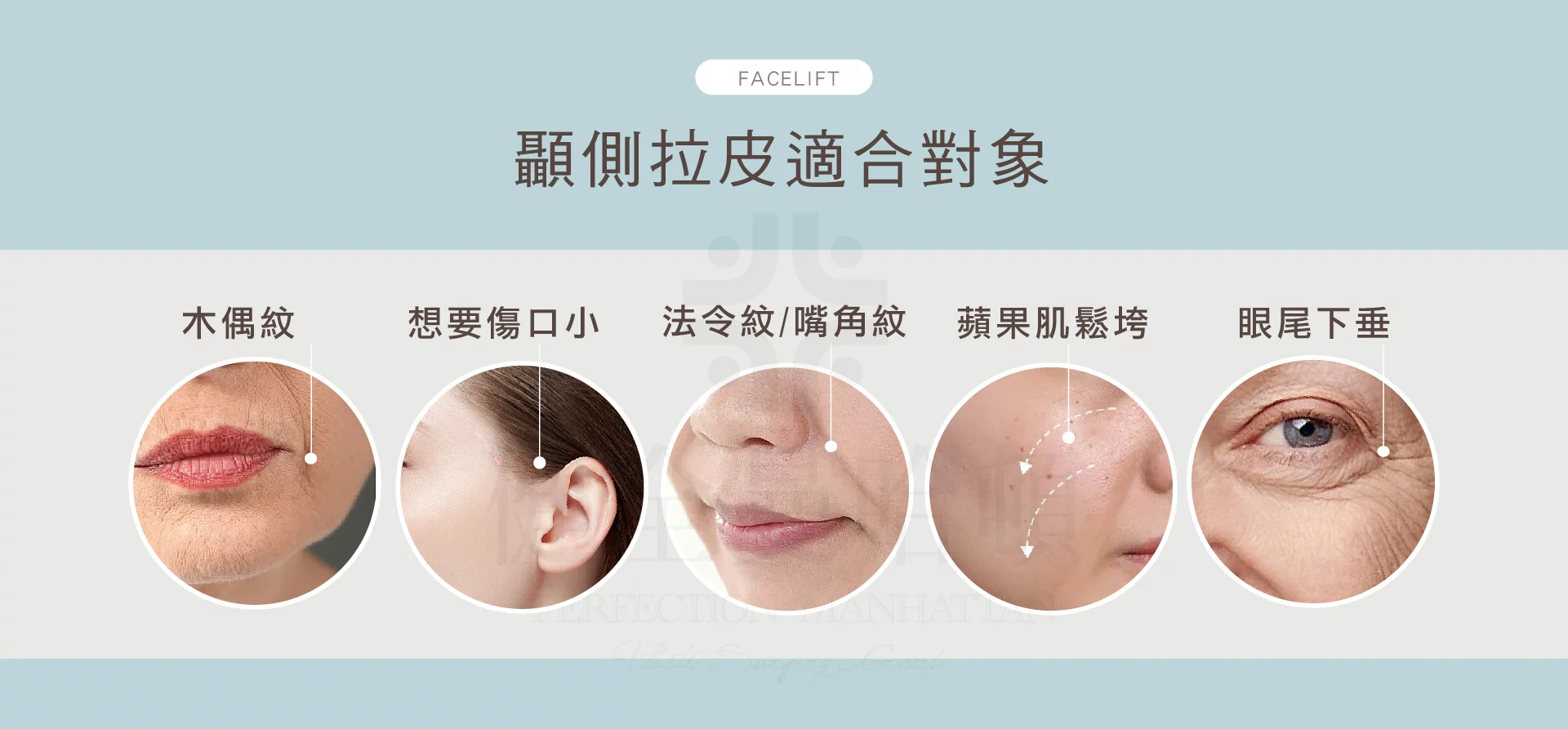 顳側拉皮 顳側部位 