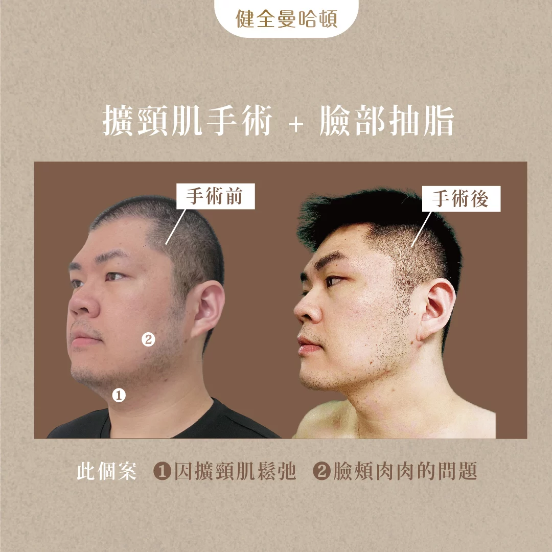 天鵝頸 傅韋傑 03