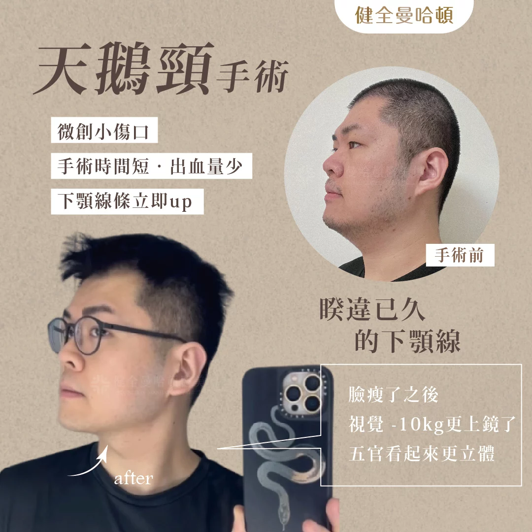 天鵝頸 傅韋傑 04