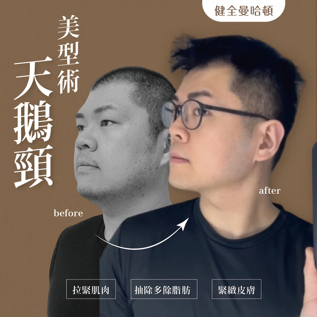 天鵝頸 傅韋傑 06