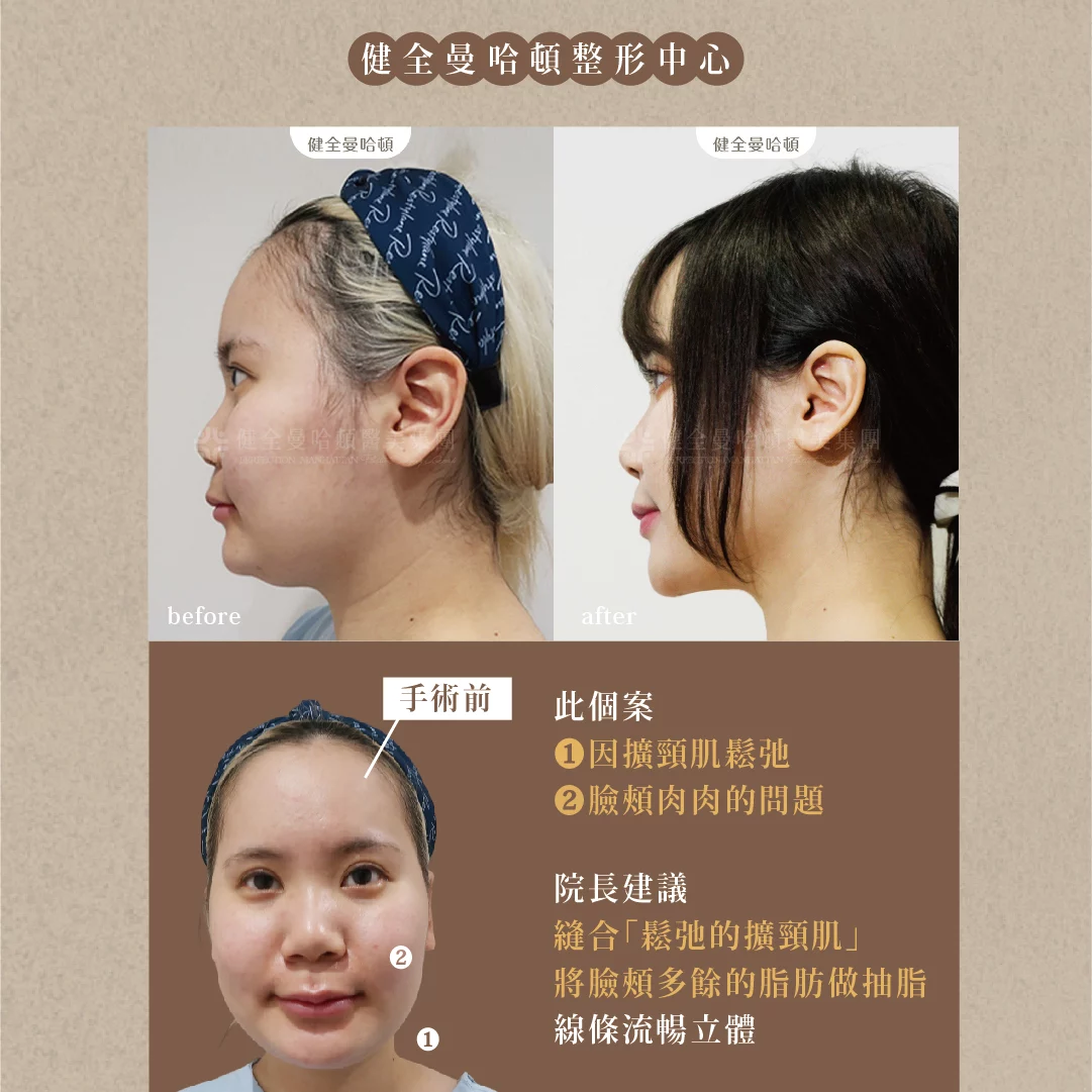 天鵝頸 張瓅勻 03