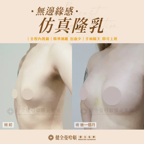 張凱煊 女王波 工作區域 1 複本 4