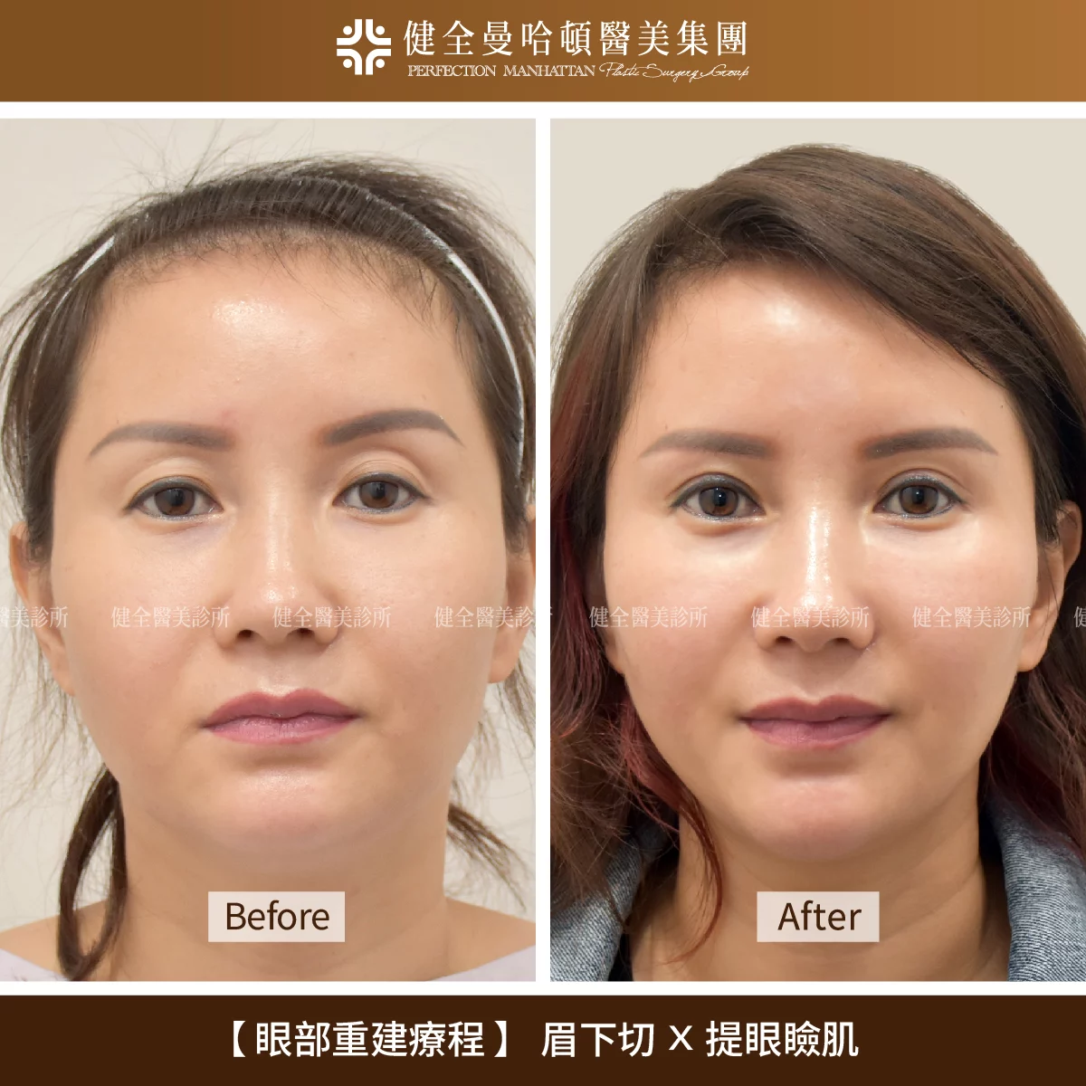 眉眼重塑 張素貞 01