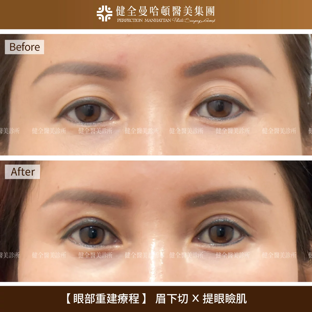 眉眼重塑 張素貞 04