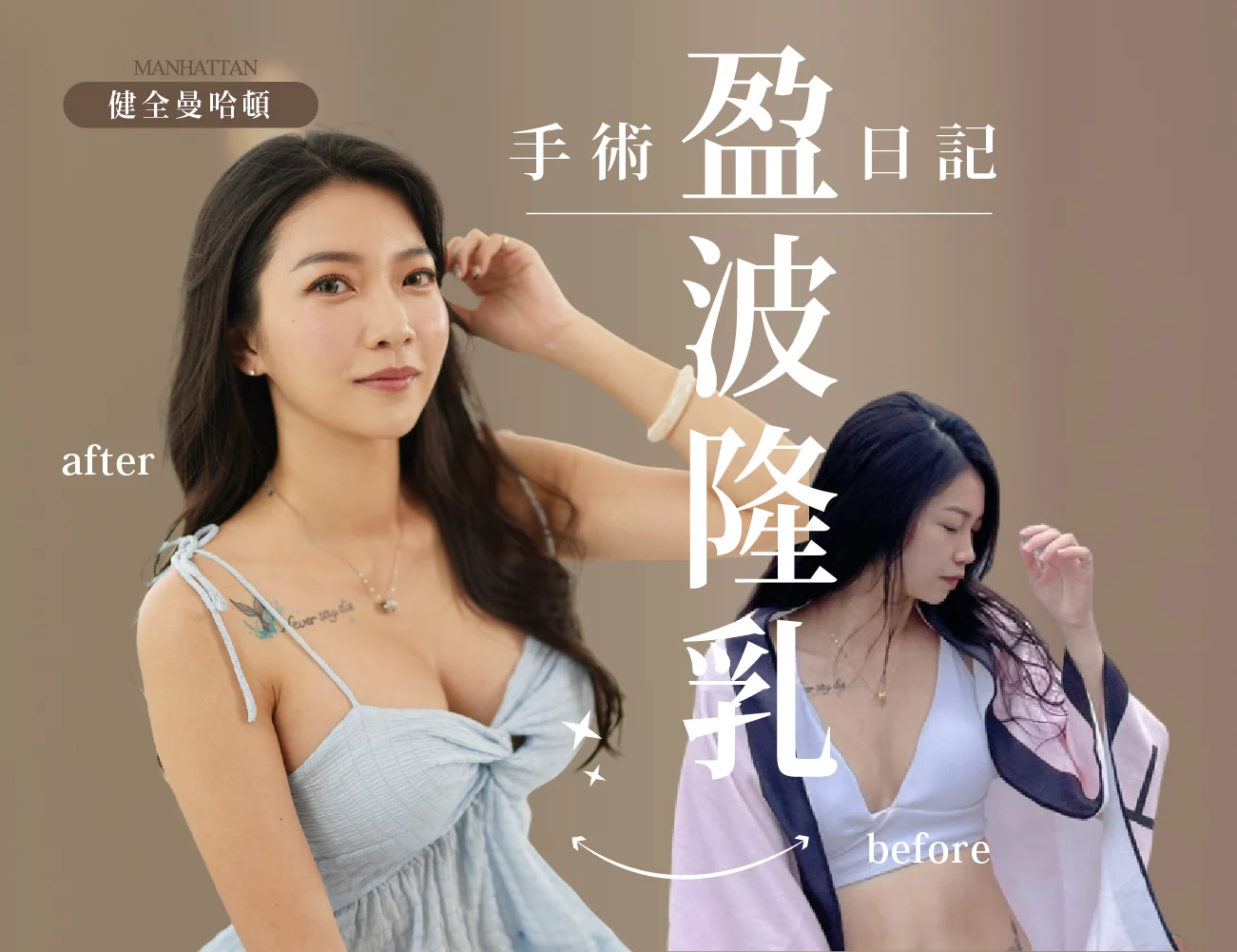 隆乳 簡怡萱 Banner